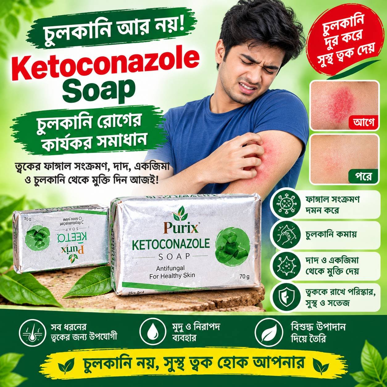 চুলকানির সাবান